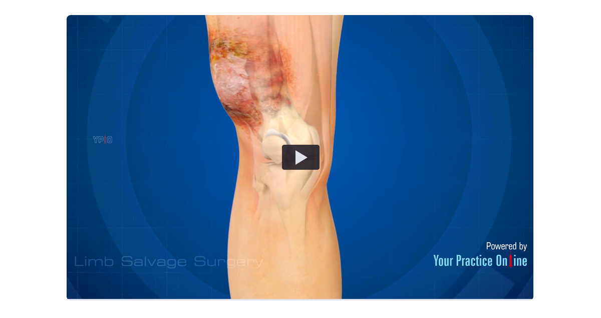 Patient Educational Video